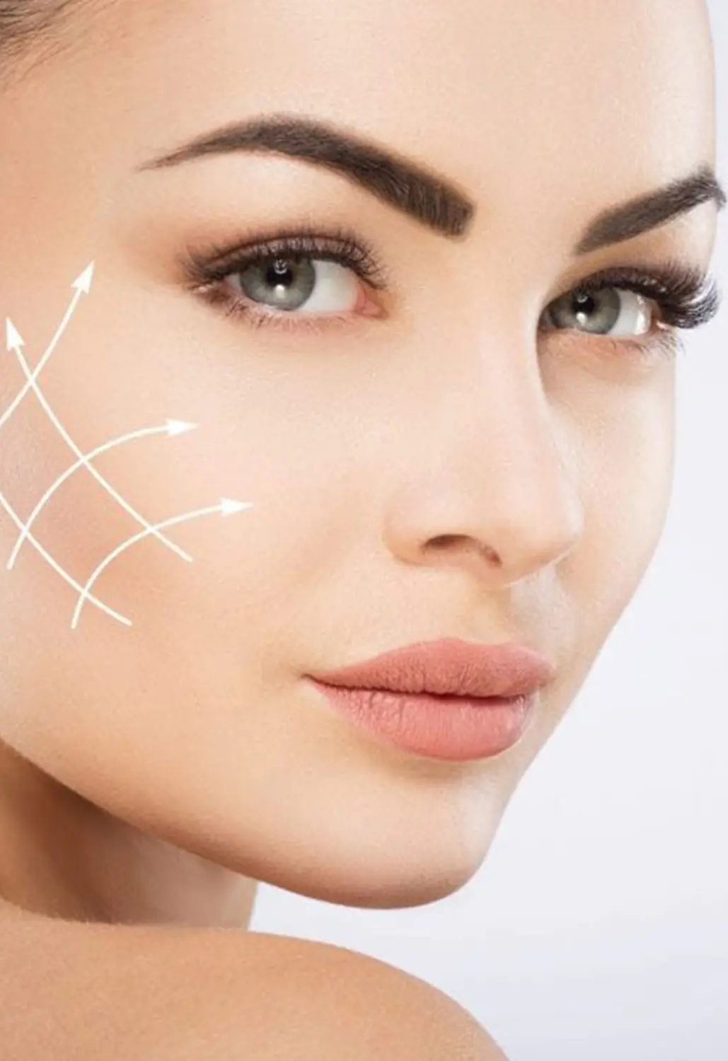 Kollagenfadenlifting von Nataschas Beautypalast